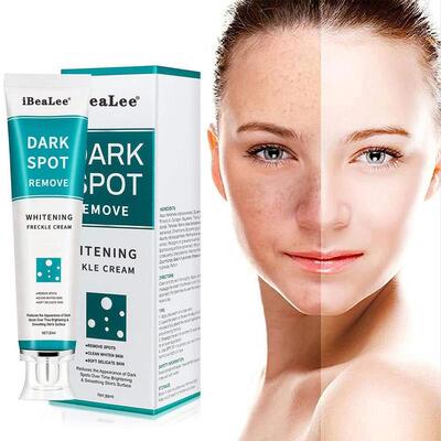 Whitening And Freckle Cream Lightening Pigmentation Mild Fre