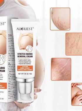 2022 Stretch Marks Removal Repairing Cream Maternity Fade Bu
