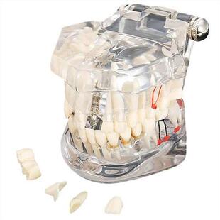 Tooth model model dental care model denture dentist Dental D