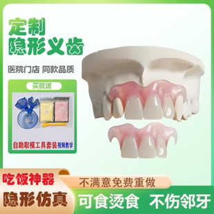 隐形义齿门牙假牙定制遮丑隐形假牙假牙齿仿真临时牙 假牙牙科同款