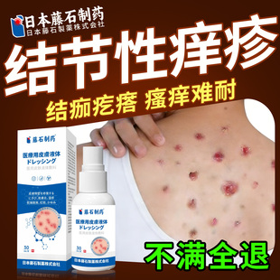 结节性痒疹专用喷剂顽固红硬疙瘩皮肤止瘙痒特小腿胳膊效红斑膏EH