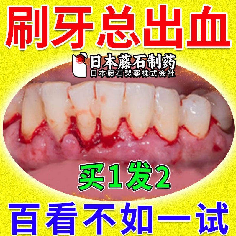牙龈出血专用可搭牙膏牙周炎口腔牙龈萎缩止血抗敏美白去口臭BD
