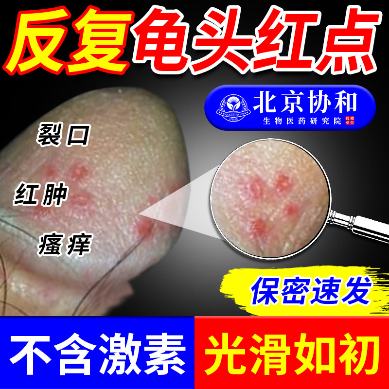 龟头上有小红点红肿脱皮粘膜裂口包皮炎症白垢真菌感染药监备案sc