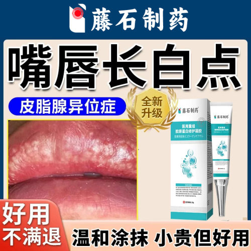 嘴唇小颗粒温和型抹膏