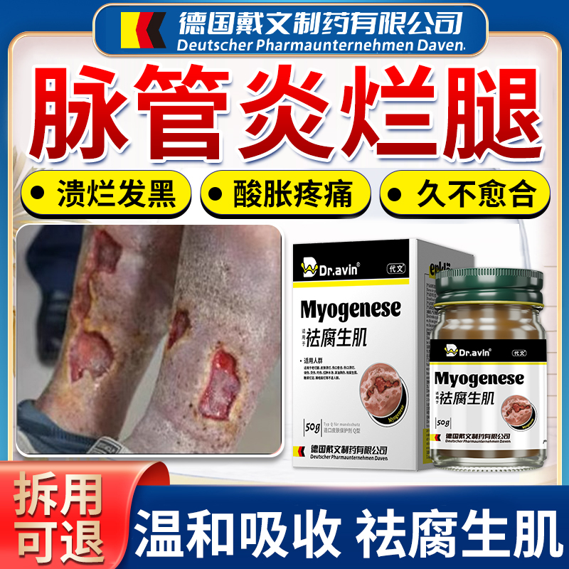 【德国监制】脉管炎老烂腿专用膏