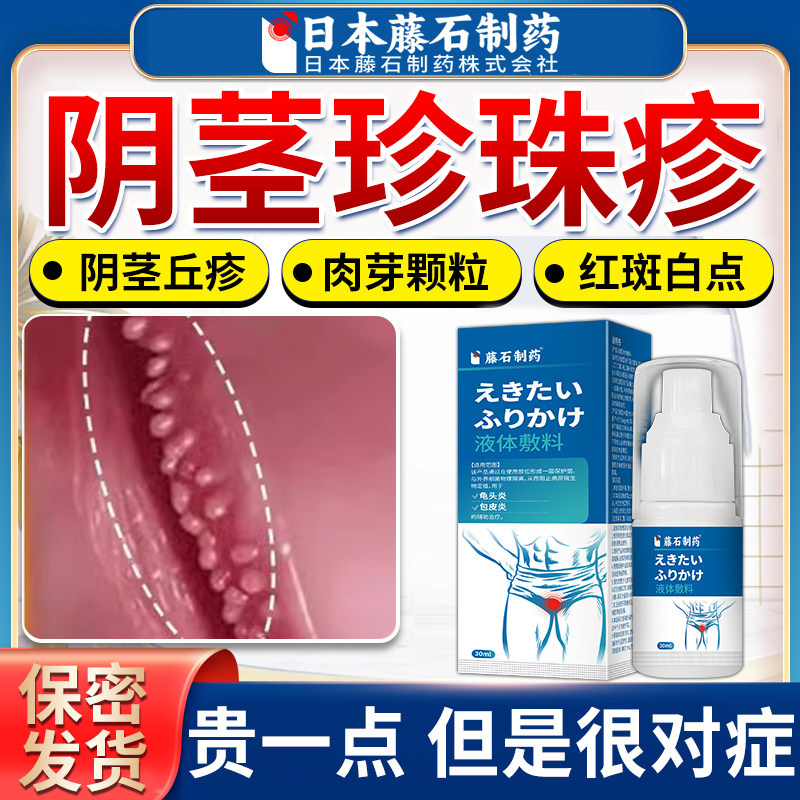 龟头珍珠丘疹去冠状沟阴茎包皮下面珍珠疹粒水泡皮疙瘩AZ