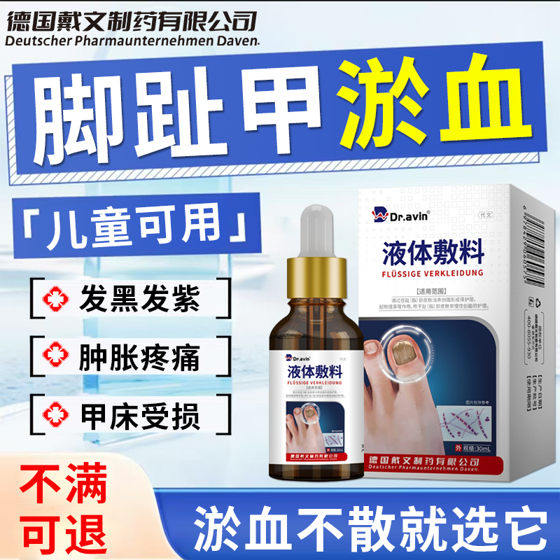 脚趾甲淤血指甲被砸被夹甲床受损发黑发紫淤血不散生长液GZ