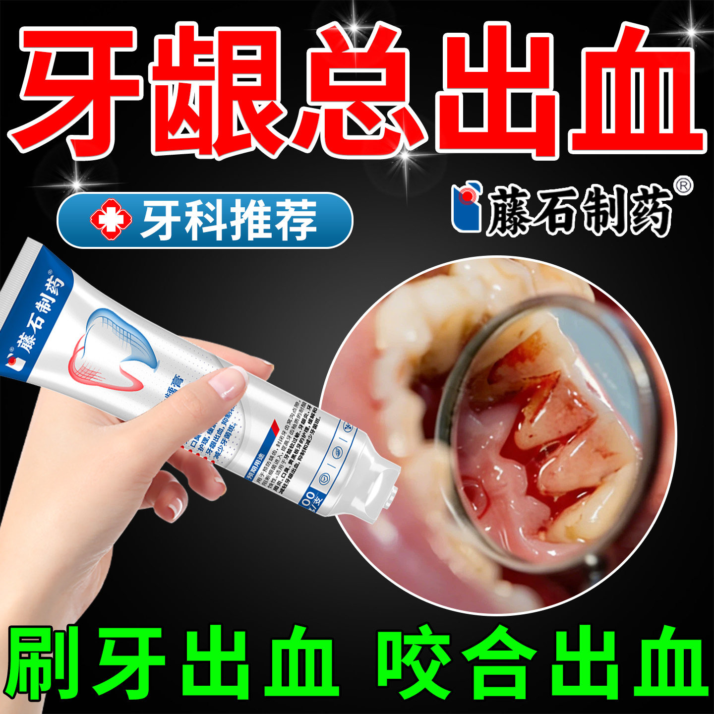 牙龈出血专用牙周炎止血双效抗敏牙龈炎萎缩肿痛消炎搭牙膏云南KP