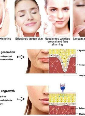 Ifting Lip Filler Hyaluron Pen High Pressure Hyaluronic Aci