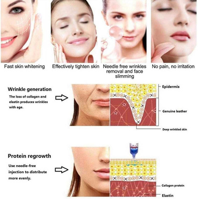 Ifting Lip Filler Hyaluron Pen High Pressure Hyaluronic Aci