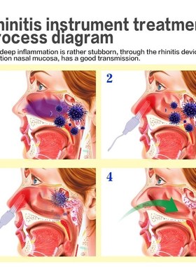 Dropshipping BioNase Nose Rhinitis Sinusitis Cure Therapy Ma