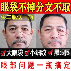 消浮肿神器眼带霜男士专用