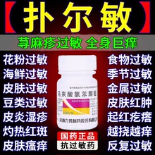 扑尔敏100片寻荨麻疹过敏止痒药膏根断止痒特效专用药皮肤瘙痒ph
