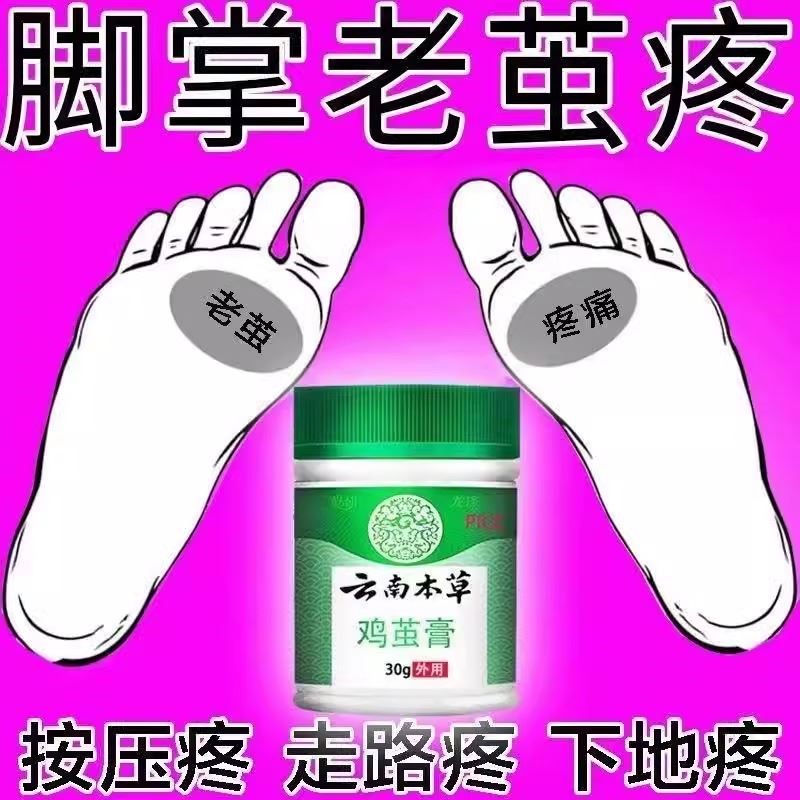 老茧脚底板死皮脚茧去除神器软化剂根部死皮脚垫脚跟手茧专用药膏