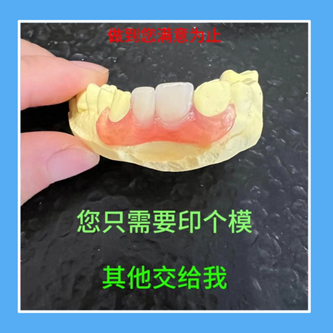 定制隐形义齿活动假牙套门牙遮丑