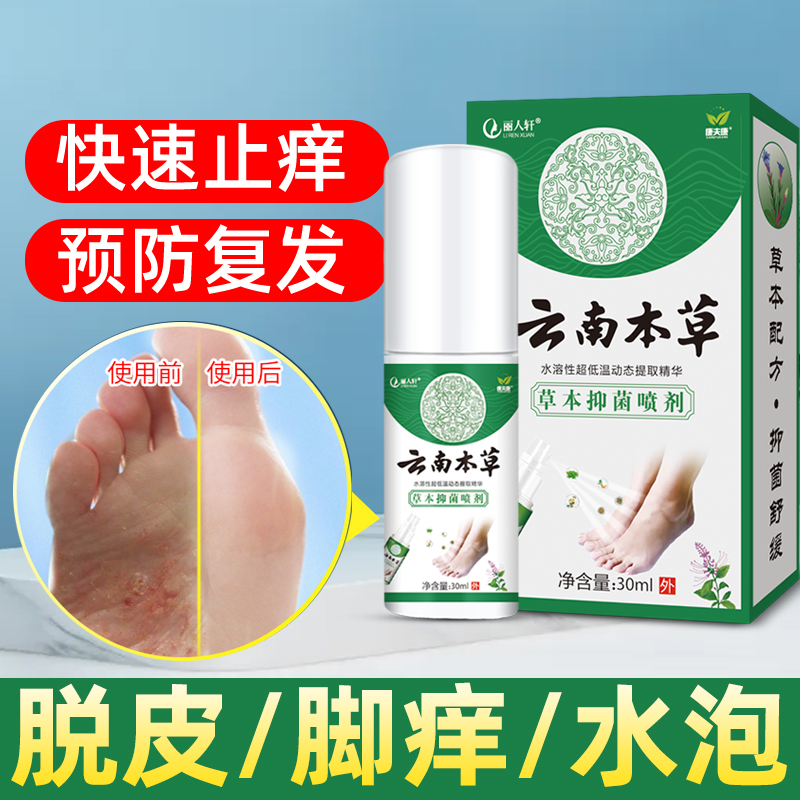 脚痒水泡脱皮烂脚丫杀菌止痒膏脚臭脚气起小水泡脚趾缝头开裂抑菌