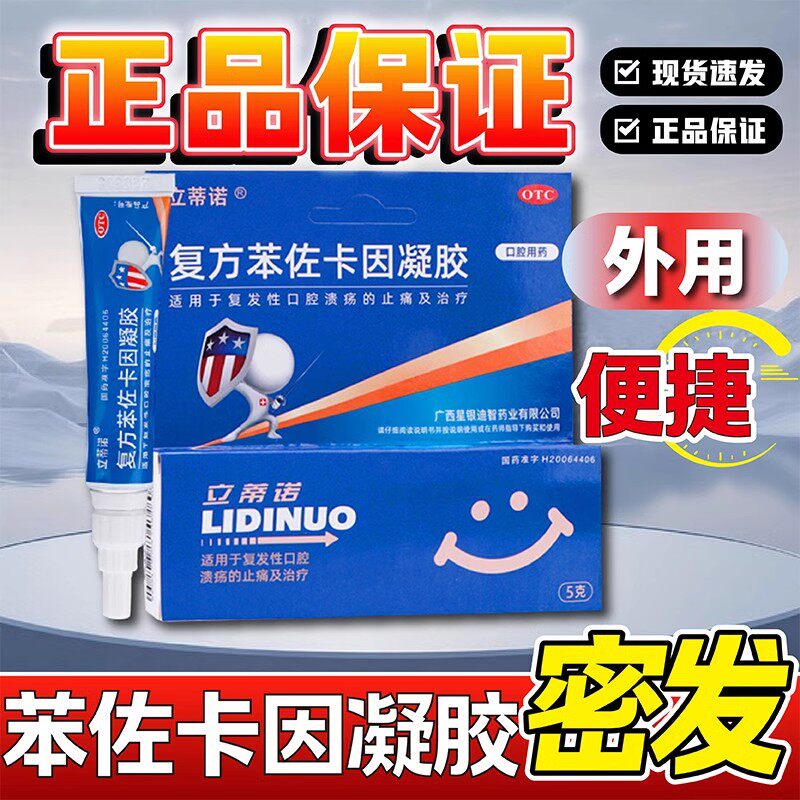 立蒂诺复方苯佐卡因凝胶治疗复发性口腔溃疡外用延时止痛药膏