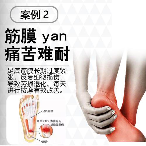 奇魔师指压板穴位足底筋膜按摩器脚部足垫脚底足疗仪疏通搓捏步按