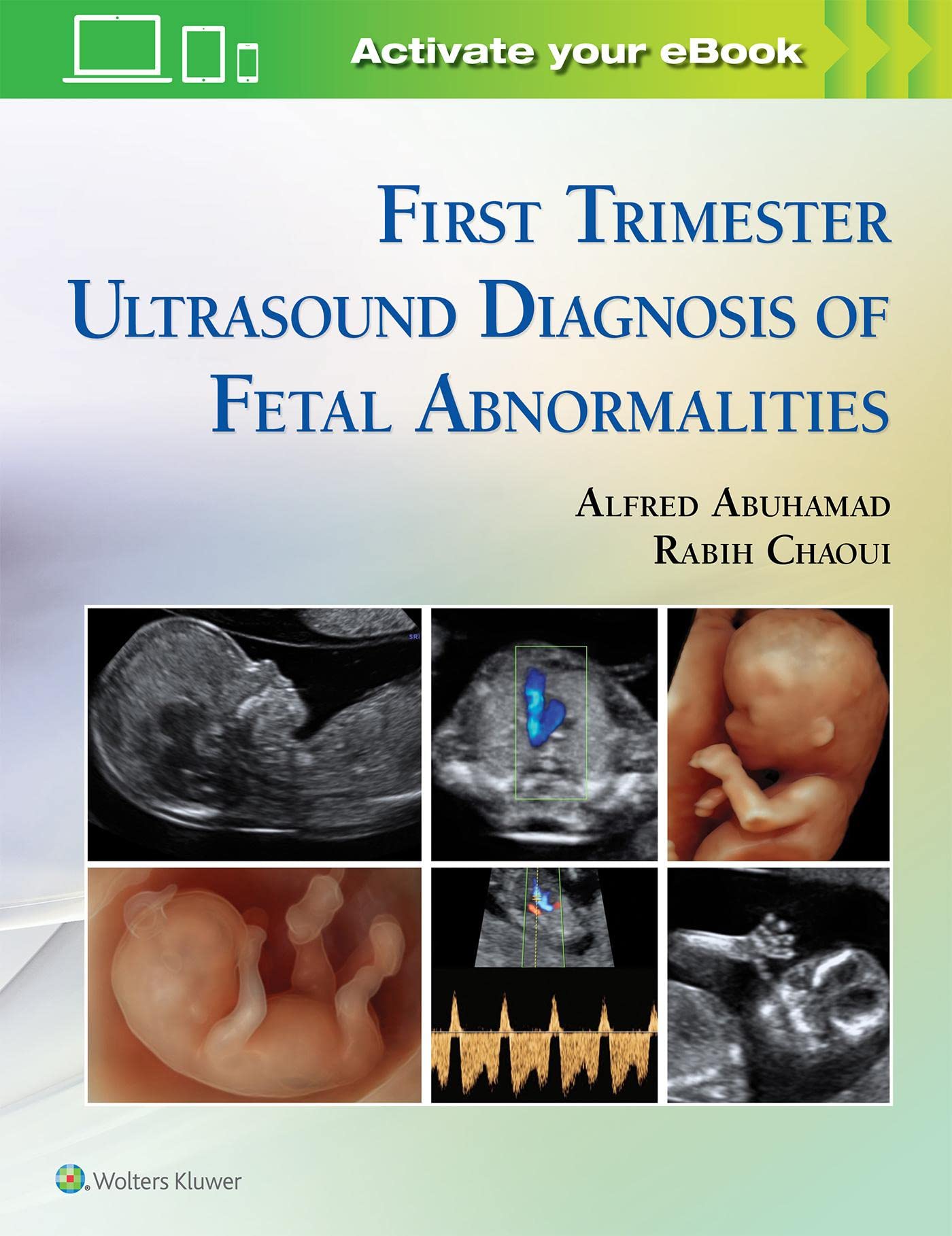现货 英文原版 First Trimester Ultrasound Diagnosis of Fetal Abnormalities 9781451193725