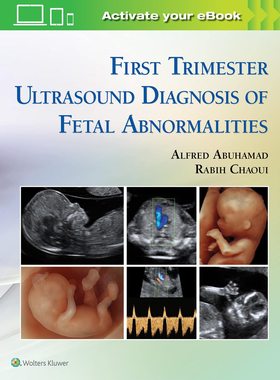 现货 英文原版 First Trimester Ultrasound Diagnosis of Fetal Abnormalities 9781451193725