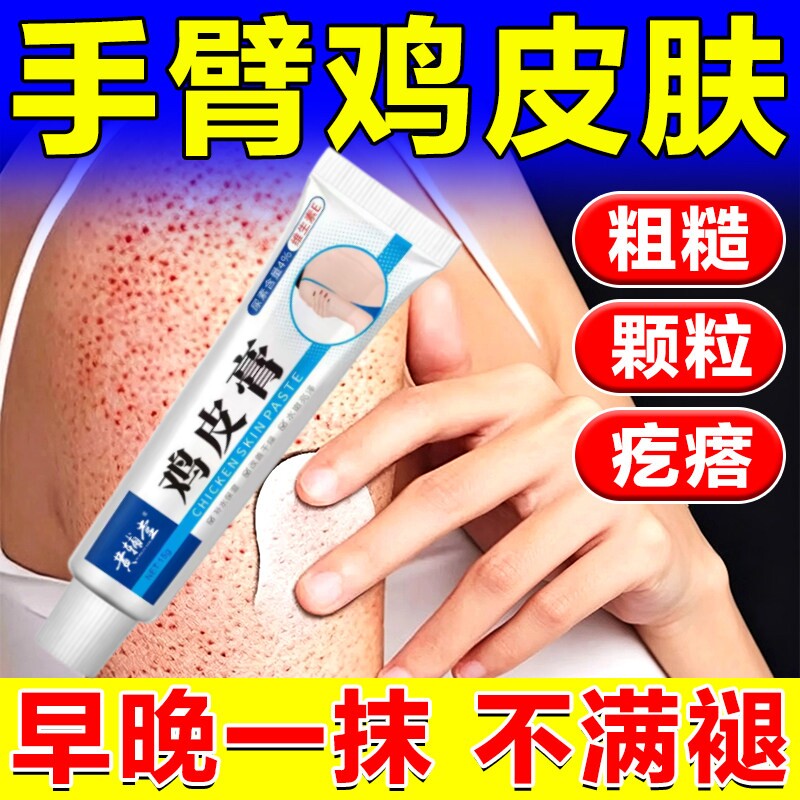【去鸡皮神器】手臂疙瘩毛襄毛周皮肤消毒护理（消）