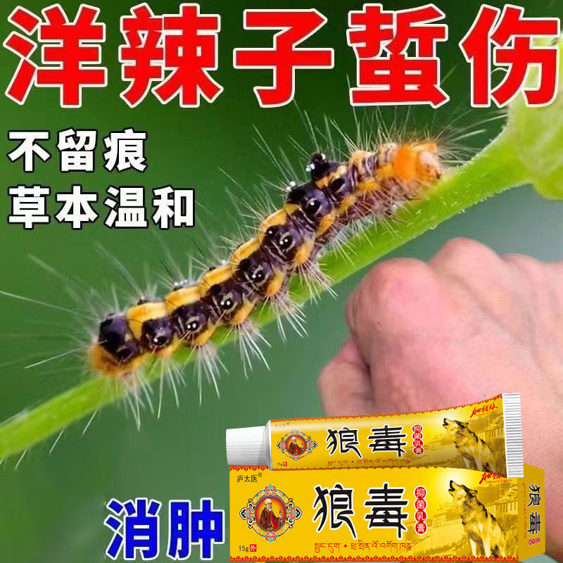 洋辣子蜇伤止疼止痒专用膏药刺蛾毛毛虫毒虫咬伤消毒快速消肿偏方