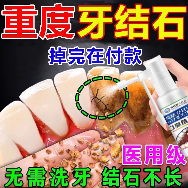 日本牙结石神器牙垢喷雾牙黄口臭口腔清洁清洁牙结石牙垢烟渍抗菌,洗护清洁剂/卫生巾/纸/香薰,口鼻清洁杀菌消炎剂,淘宝优惠券,粉丝福利购,淘宝优惠卷