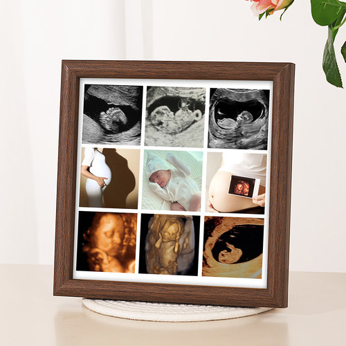胎儿b超相框宝宝b超纪念相框