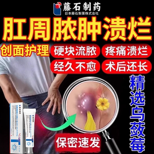 肛瘘肛周脓肿膏去腐生肌拔毒膏药房同售物乌蔹莓软膏QK