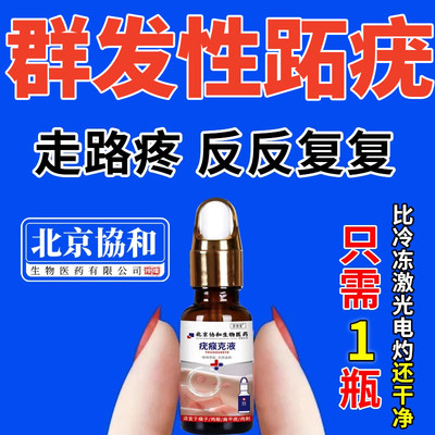 跖疣专用膏去根足部脚底疣