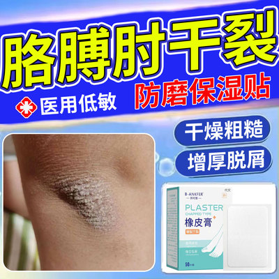 胳膊肘干裂贴手肘干燥起皮开裂关节癣皮炎膏去死皮神器去黑防磨SK