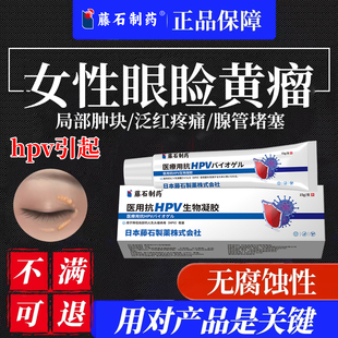女性眼睑黄瘤去眼皮黄斑瘤专用膏去眼角眼皮斑黄疣脂肪粒汗管瘤QK