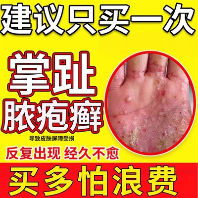 掌趾脓疱病掌跖脓包角化病症QK专用手脚脓包角化脱皮干裂