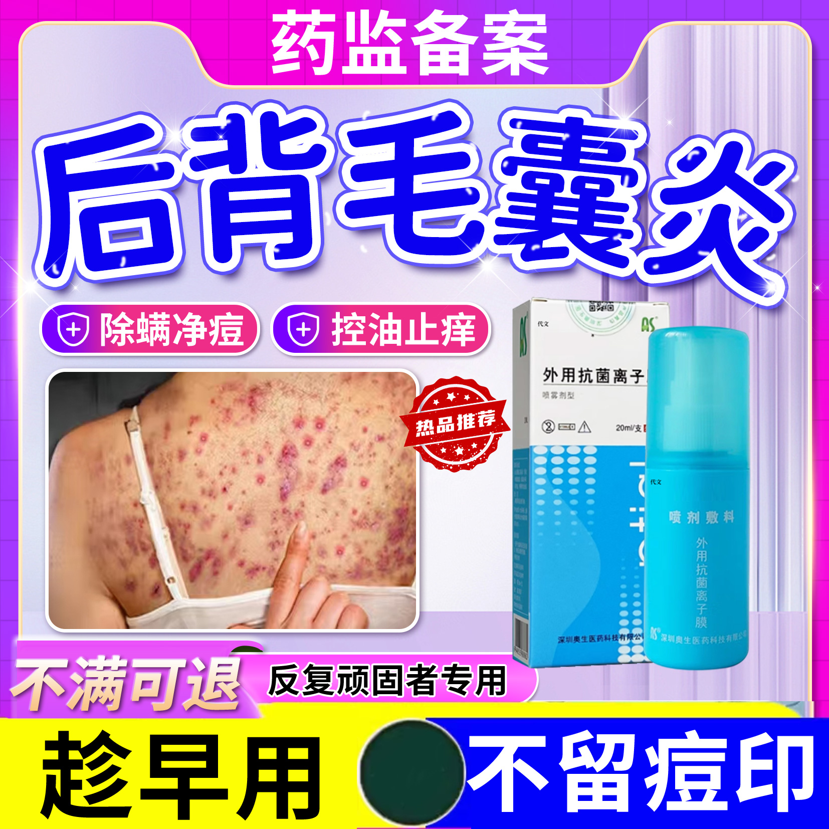 背上长痘痘毛囊炎除螨祛痘痒毛囊炎喷雾剂果酸换肤刷酸医用护理js