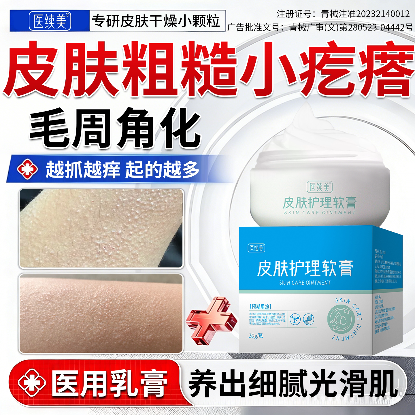 皮肤粗糙瘙痒小颗粒疙瘩去鸡皮肤毛囊周角化症专用胳膊腿身体乳RW
