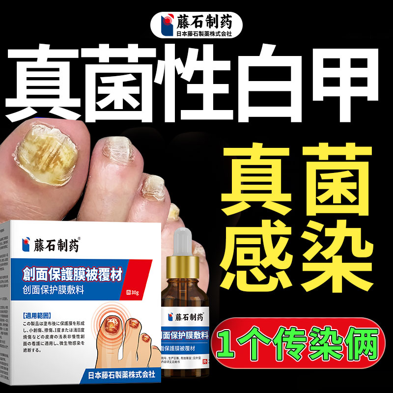 真菌性白甲手脚指甲发白有白斑点空甲床分离分层灰指甲真菌感染QK