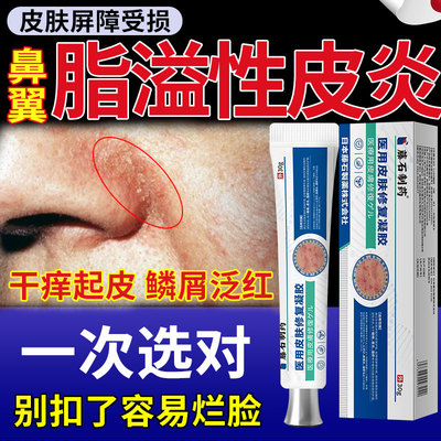 鼻子鼻翼两侧泛红发红脱皮脂溢性皮炎面部马拉色菌软膏面部脸部QK