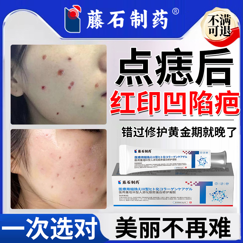 点痣斑后去红印黑印修复液凹坑凹陷疤痕膏淡化胶原蛋白凝胶正品QK