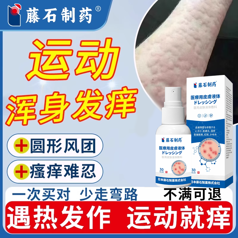 胆碱能性荨麻疹专运动就痒热遇发作情绪紧张进食辛辣压力极痒CA