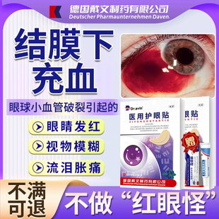 结膜下出血眼底充血眼贴眼角眼睛有血块血管破裂血糖高眼模糊QK
