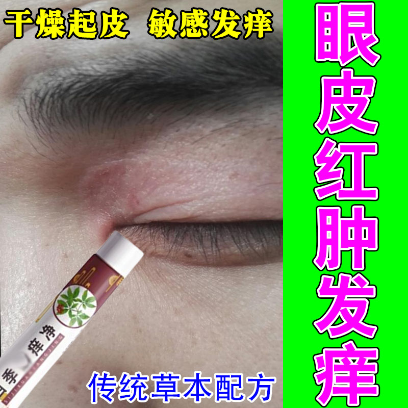 眼皮红肿粗糙痒眼睛周围过敏发痒神经性干燥起屑保湿修护软膏