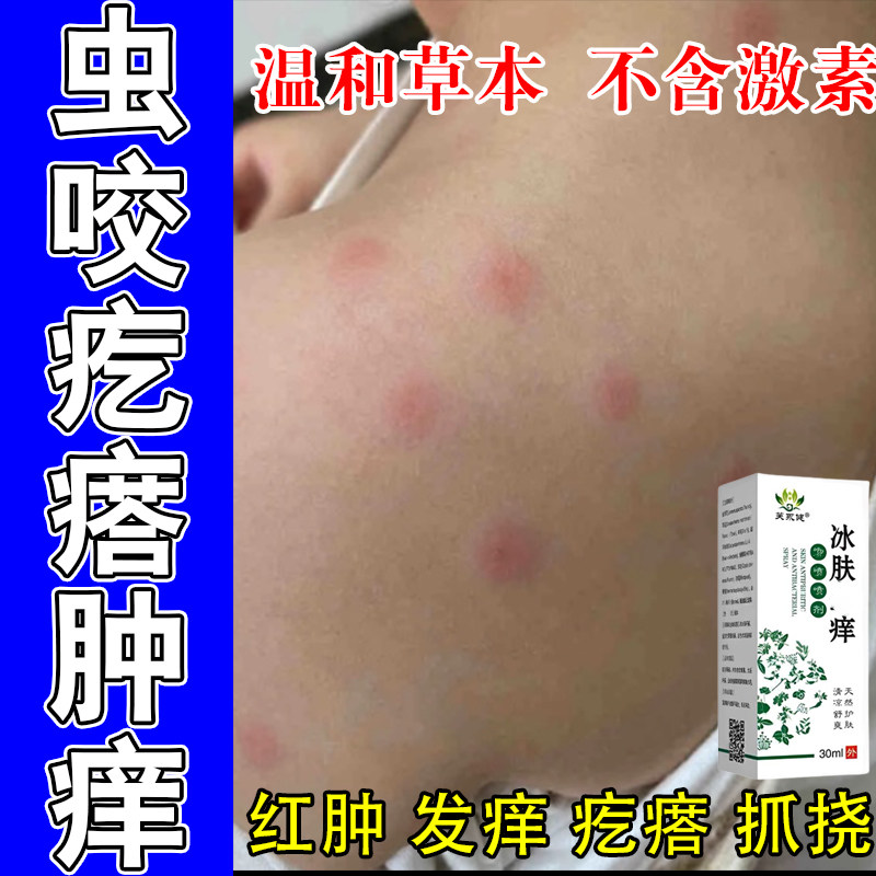 冶孩子身上疙瘩蚊虫叮咬胳膊腿起疙瘩红肿刺痒红疙瘩草本萃取喷剂