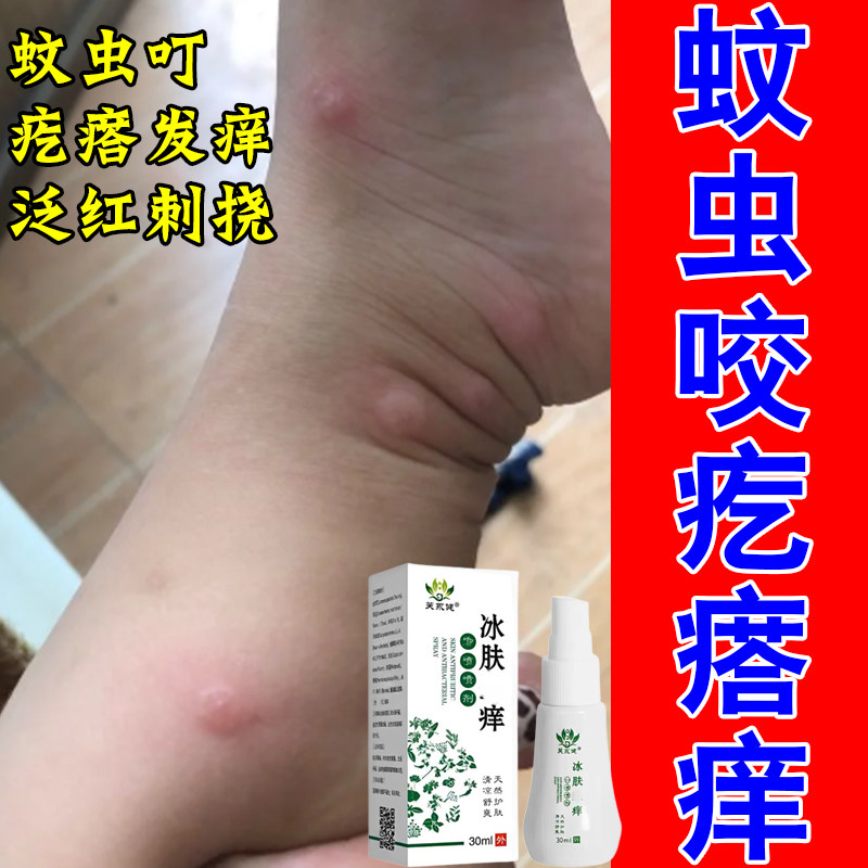 宝宝身上长疙瘩蚊虫红蚂蚁虫叮咬红肿过敏痒起疙瘩包修护喷剂