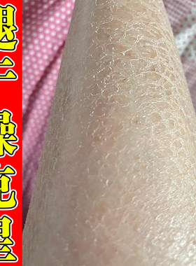 蛇皮肤霜专用去腿部皮肤干燥起皮身体乳