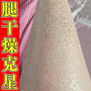 蛇皮肤去身体乳病去除干燥起皮疙瘩毛囊角质化