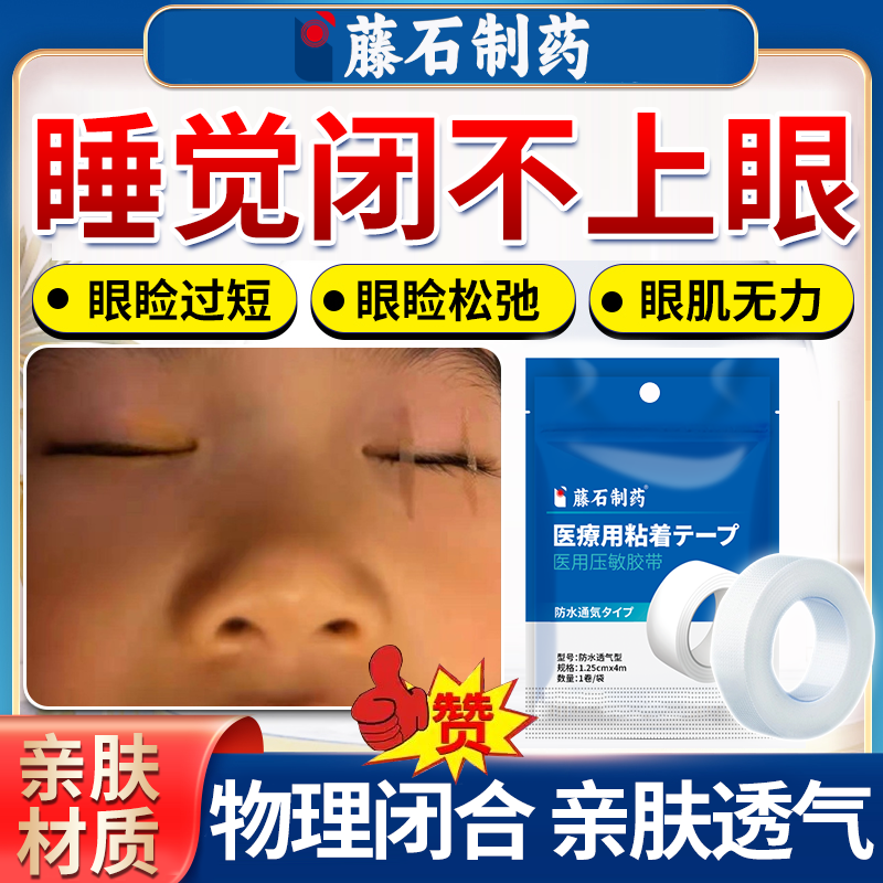 睡觉眼睛闭不上眼睑闭合不全眼贴闭眼贴睡觉防睁眼贴封眼贴神器OZ