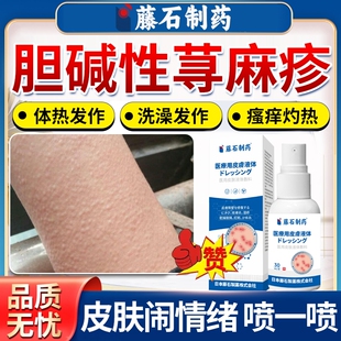 胆碱性寻荨麻疹过敏止痒喷雾断风团根胆碱能性可搭药房膏沐浴露OZ