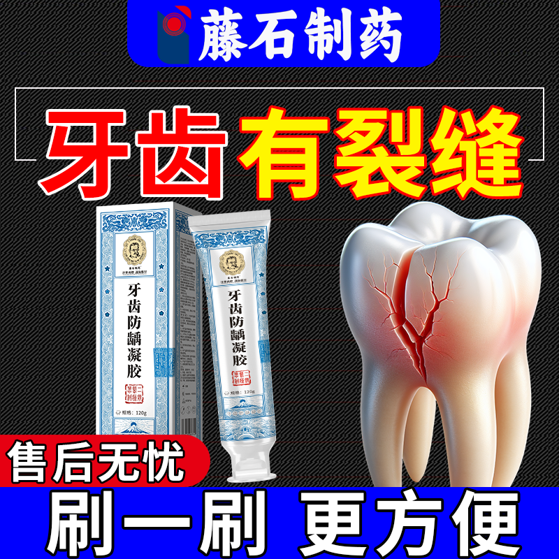 牙齿修复液开裂仿生牙裂缝修补断牙裂纹牙隐裂搭牙膏牙裂牙龈康OZ