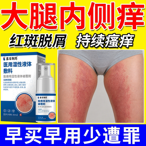 【医用级别】大腿内侧股藓痒喷雾