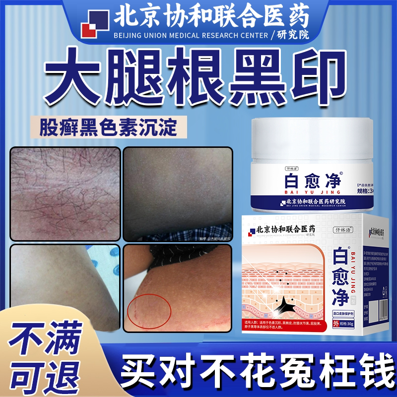 股藓去黑色素沉淀积男黑印疤股廯去除大腿内侧股沟藓根部黑斑癣em